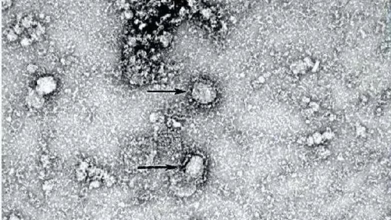 Получены первые снимки нового коронавируса