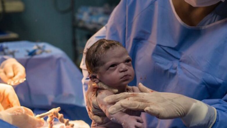 Снимок «угрюмой» новорожденной стал вирусным в сети
