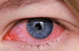 Медики предупредили о новом штамме неизлечимого глазного гриппа