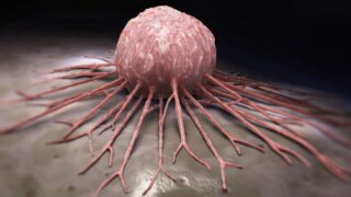Ученые смогли подавить «бессмертие» в раковых клетках