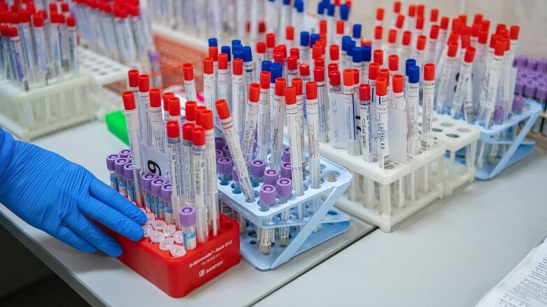 В России зарегистрирована тест-система для определения антител к COVID-19