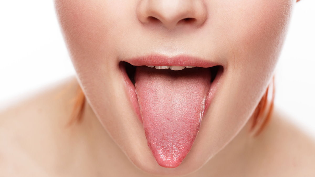 признаки диабета на языке и во рту