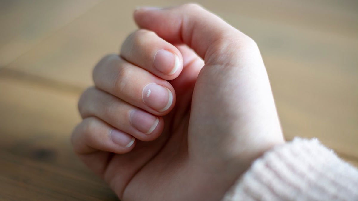 рука ногти пальцы кисть белое пятно