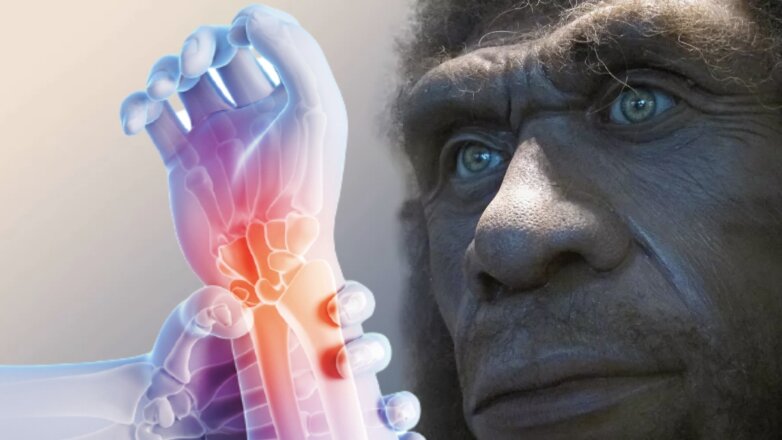 Неандертальцы страдали популярной болезнью современного человека