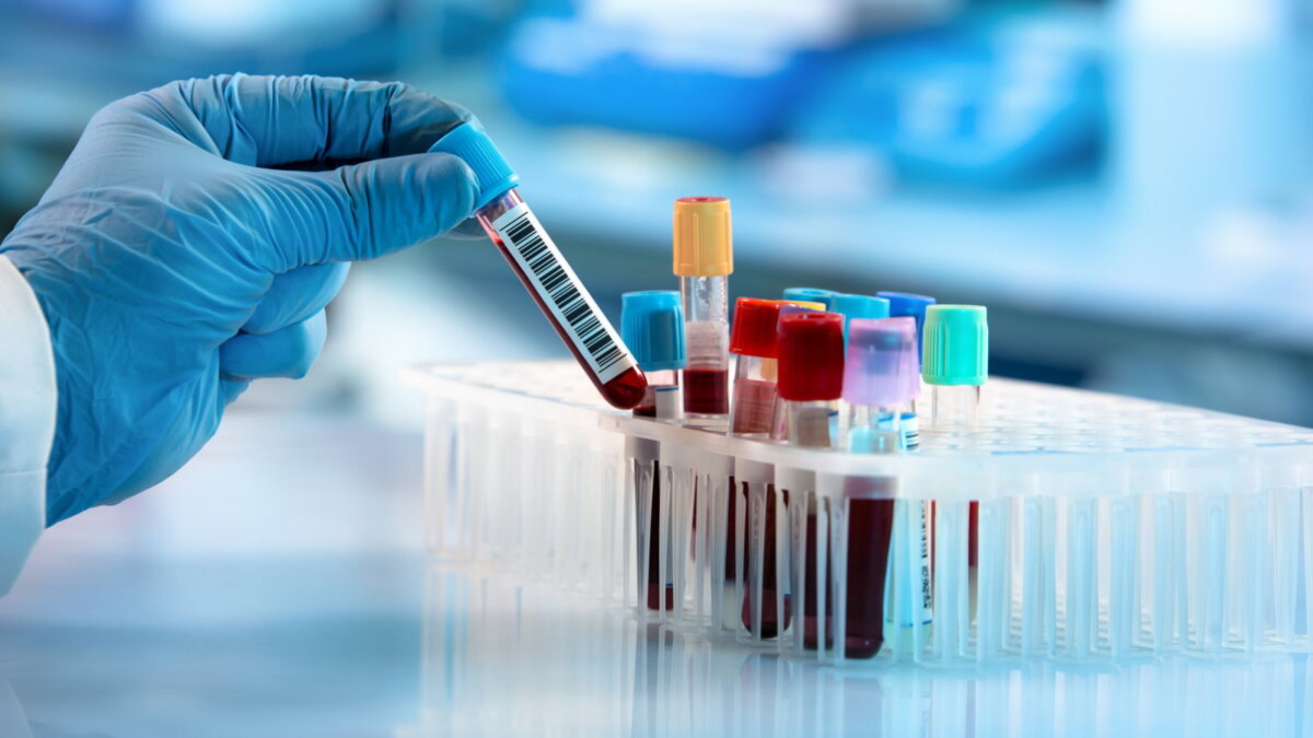 анализ крови пробирки лаборатория один