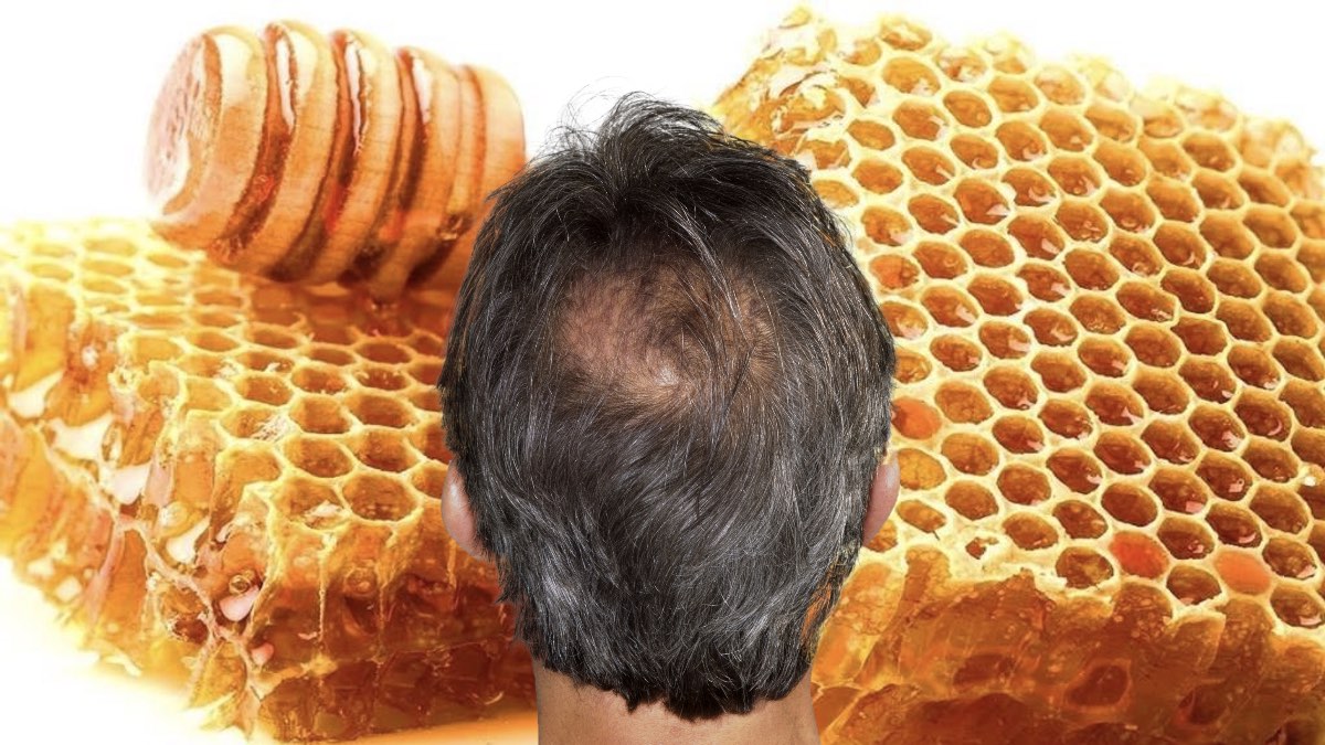 Ускорить рост волос и предотвратить их выпадение поможет мед