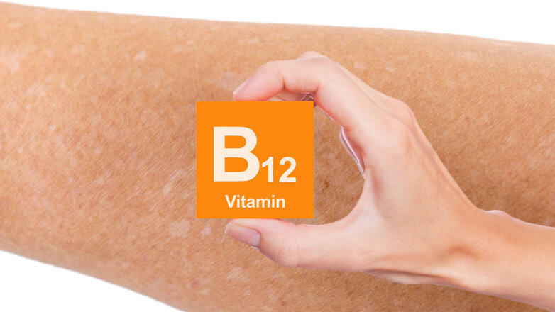 Пятна на теле связали с дефицитом витамина B12