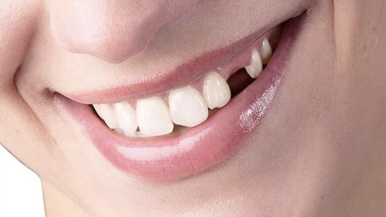 Ученые нашли способ восстанавливать выпавшие зубы