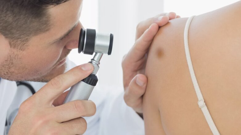 Рак кожи: как снизить риск заболевания рассказал эксперт
