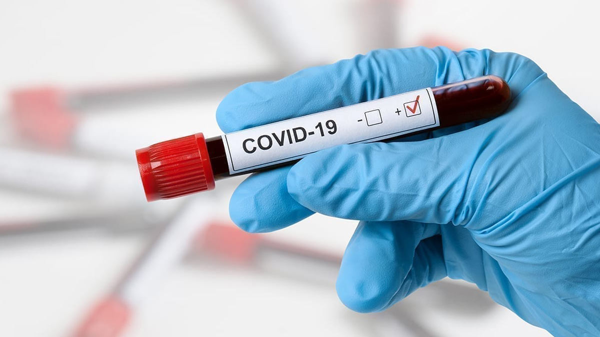 положительный тест covid