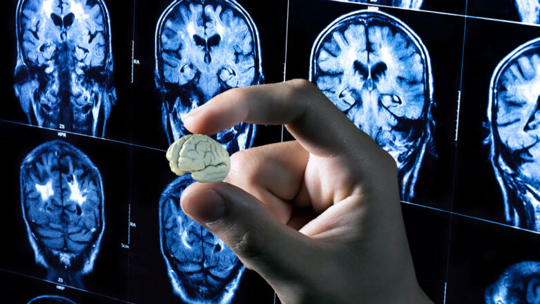 Человеческий мини-мозг: лечение главного органа может выйти на новый уровень