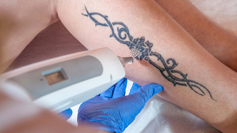 Исправляя ошибку: можно ли вывести татуировку