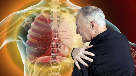 Рак легких: 5 неожиданных симптомов опасного заболевания