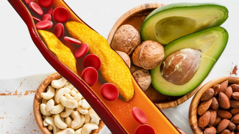 Высокий холестерин: продукты, которые помогут улучшить показатели