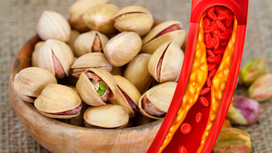 Ученые назвали вкусное средство от высокого холестерина