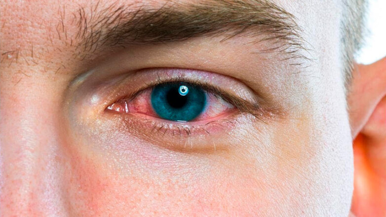 Качество зрения: когда покраснение глаз требует обращения к врачу