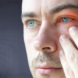 Качество зрения: почему глаза чешутся и краснеют