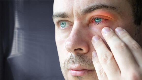 Качество зрения: почему глаза чешутся и краснеют