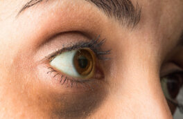 Качество зрения: почему белки глаз меняют цвет и когда это опасно