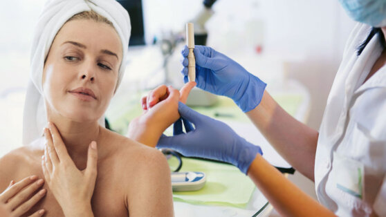 Преддиабет: на высокий сахар в крови укажет необычный симптом на коже