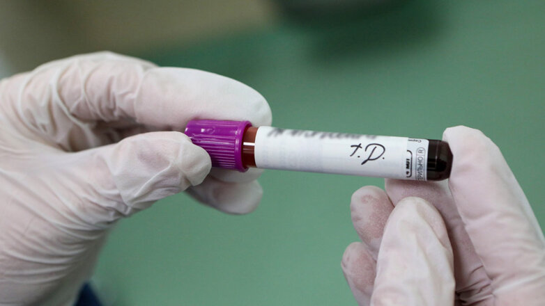В России зарегистрировали тест на антитела у переболевших COVID-19 бессимптомно