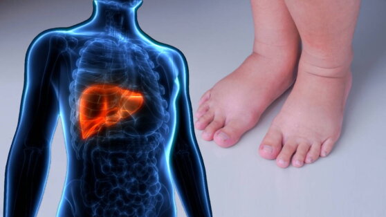 Здоровье печени: симптомы, при которых необходимо обратиться к врачу