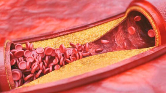 Мифы о холестерине: специалисты перечислили 5 распространенных заблуждений
