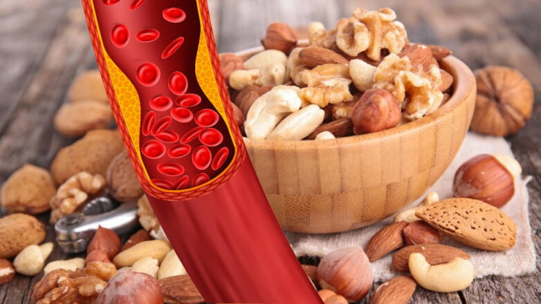 Высокий холестерин: 5 продуктов для его снижения назвали медики