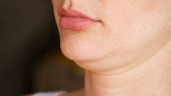 Как избавиться от второго подбородка: 3 простых упражнения