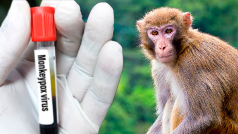 Вирусолог Альтштейн оценил вероятность пандемии оспы обезьян