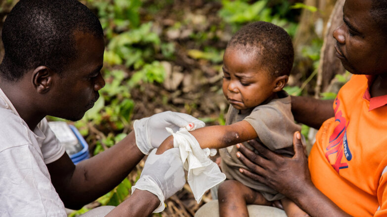 Ребенок, зараженный оспой обезьян, во время лечения в центре Международной медицинской неправительственной организации "Врачи без границ" . Центральная африканская Республика.