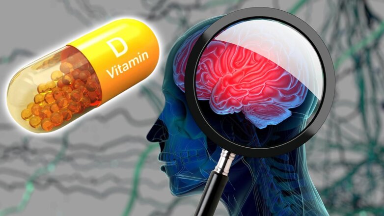 Что разрушает мозг: дефицит важнейшего витамина связали с повышенным риском деменции