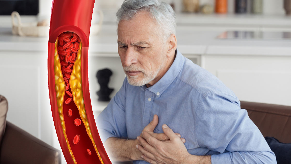 Холестерин и сердечно-сосудистые заболевания