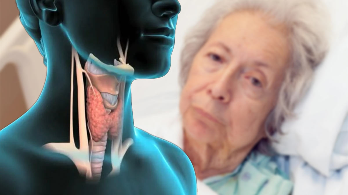 Проблемы с щитовидной железой способны на 81% увеличить риск деменции