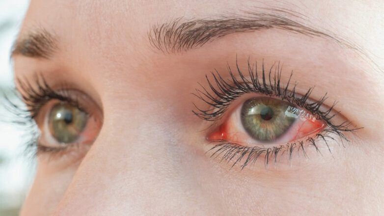 Качество зрения: 4 неочевидных признака проблем с глазами