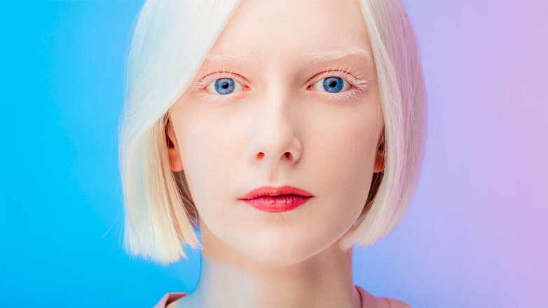 Какой сегодня праздник: 13 июня – День распространения информации об альбинизме