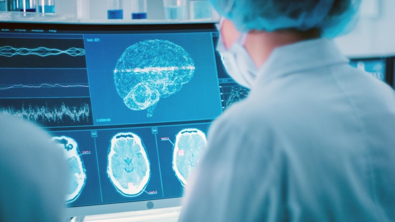 В Новосибирске создали программный модуль для диагностики опухолей мозга