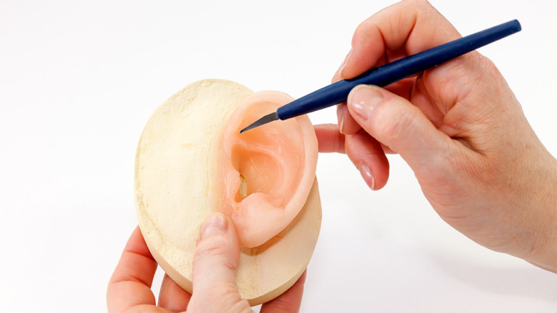 В Перми разработали бионический протез уха, максимально приближенный к реальному