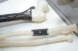 Российские ученые разработали "цифровой конструктор" для создания искусственных костей