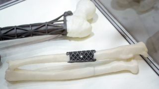 Российские ученые разработали "цифровой конструктор" для создания искусственных костей