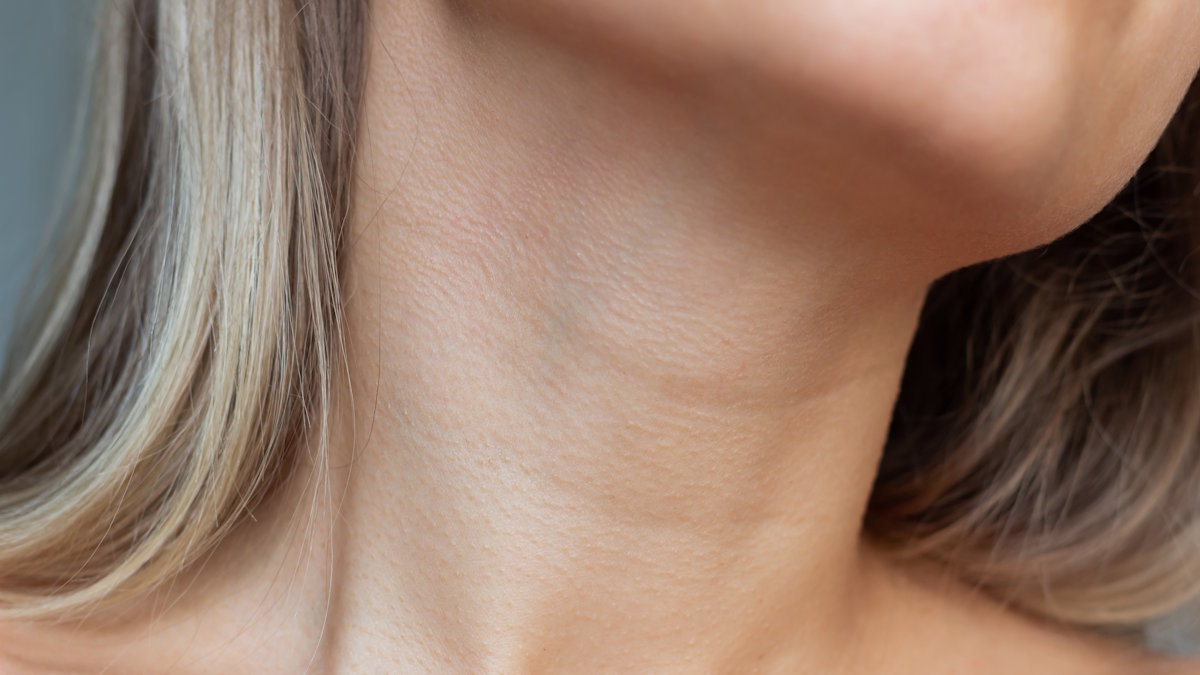 Складки на шее: почему возникают и как от них избавиться