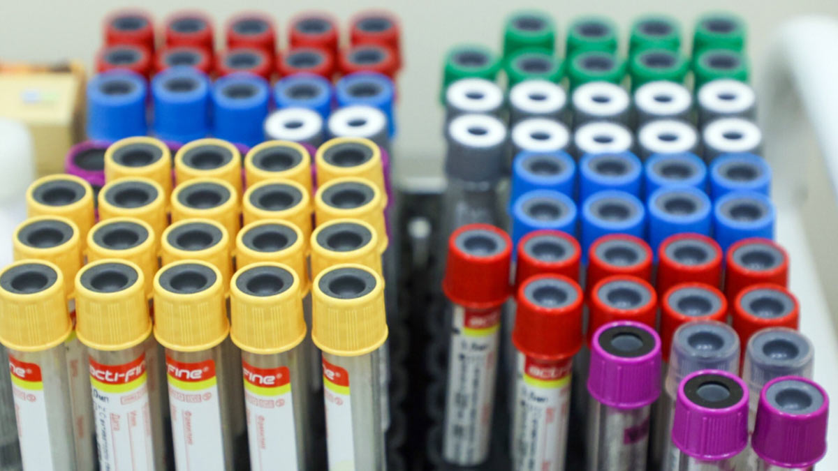 Академик Покровский сообщил об увеличении числа россиян с ВИЧ-инфекцией