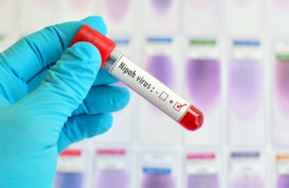 Первые симптомы вируса Нипах и меры защиты перечислили в Роспотребнадзоре