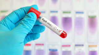 Первые симптомы вируса Нипах и меры защиты перечислили в Роспотребнадзоре