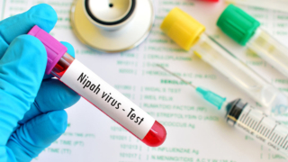 О распространении нового вируса Нипах рассказали в ВОЗ