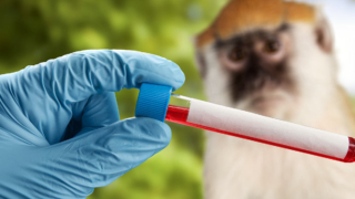 Ученые не видят угрозы эпидемии оспы обезьян в России