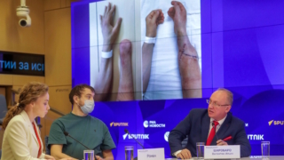 В НИИ Склифосовского рассказали, как впервые в России провели успешную трансплантацию кисти